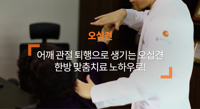 오십견