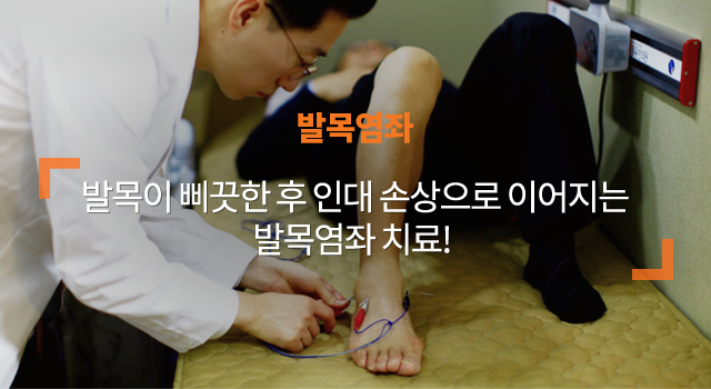 발목염좌