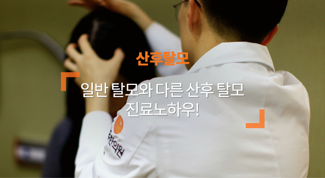 산후탈모